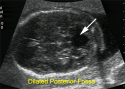 Real-Time B-Mode Ultrasound